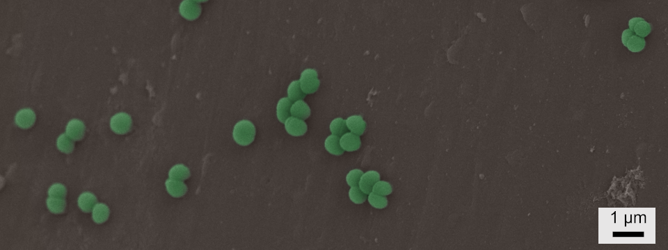 Bacteria on Surface of 3D Printed PEEK