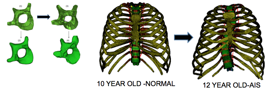 Pediatric Spine and Rib Cage Deformities